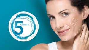 radiesse filler radiesse filler