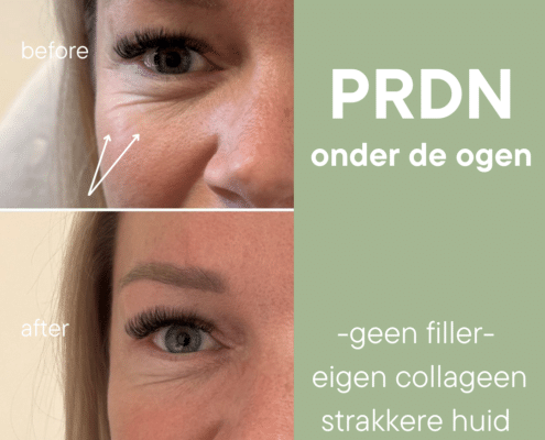 Polynucleotiden PRDN Blush